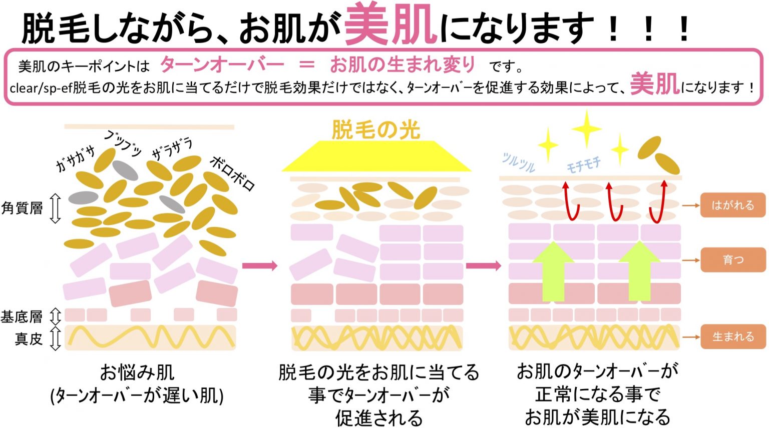 光フェイシャルの仕組み 宇佐市、中津市で脱毛・メンズ脱毛ならwarp lash